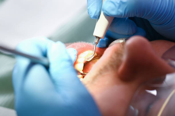 Best Emergency TMJ Treatment in Colon, MI