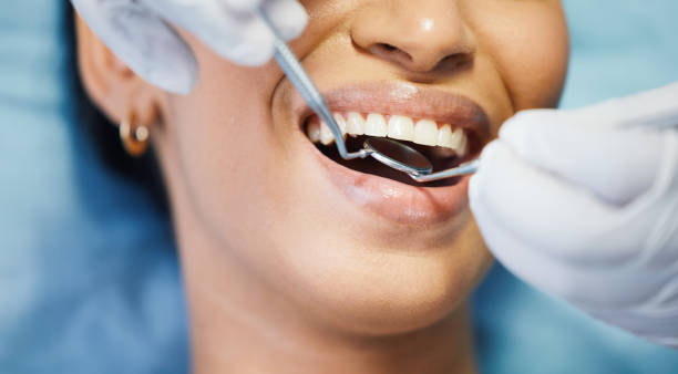 Best Emergency Gum Treatment in Colon, MI